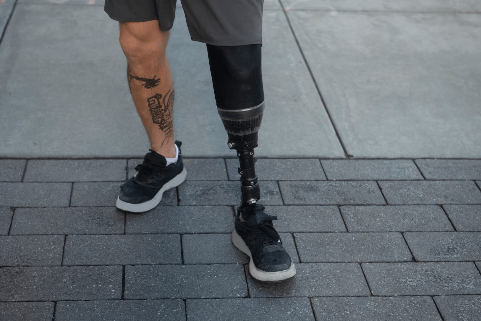 Prosthetic Foots: Restoring Mobility and Enabling Active Lifestyles